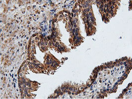 ILVBL Antibody - IHC of paraffin-embedded Human prostate tissue using anti-ILVBL mouse monoclonal antibody.