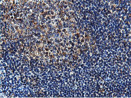 ILVBL Antibody - IHC of paraffin-embedded Human tonsil using anti-ILVBL mouse monoclonal antibody.