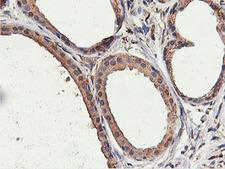 ILVBL Antibody - IHC of paraffin-embedded Human breast tissue using anti-ILVBL mouse monoclonal antibody.