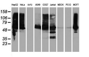 ILVBL Antibody - Western blot of extracts (35 ug) from 9 different cell lines by using anti-ILVBL monoclonal antibody.