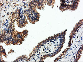 ILVBL Antibody - IHC of paraffin-embedded Human prostate tissue using anti-ILVBL mouse monoclonal antibody.
