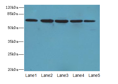 ILVBL Antibody - Western blot. All lanes: ILVBL antibody at 4 ug/ml. Lane 1: HepG-2 whole cell lysate. Lane 2: HeLa whole cell lysate. Lane 3: A549 whole cell lysate. Lane 4: Jurkat whole cell lysate. Lane 5: U87 whole cell lysate. Secondary Goat polyclonal to Rabbit IgG at 1:10000 dilution. Predicted band size: 68 kDa. Observed band size: 68 kDa.