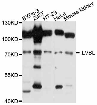ILVBL Antibody - Western blot analysis of extracts of various cell lines, using ILVBL antibody at 1:3000 dilution. The secondary antibody used was an HRP Goat Anti-Rabbit IgG (H+L) at 1:10000 dilution. Lysates were loaded 25ug per lane and 3% nonfat dry milk in TBST was used for blocking. An ECL Kit was used for detection and the exposure time was 5s.