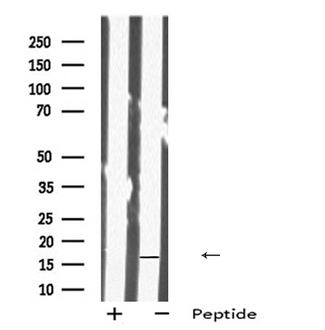 IMMP1L Antibody - Western blot analysis IMMP1L using 293 whole cells lysates