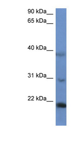 IMMP2L Antibody - IMMP2L antibody Western blot of HepG2 cell lysate.  This image was taken for the unconjugated form of this product. Other forms have not been tested.