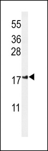 IMMP2L Antibody - Western blot of IMP2L Antibody in Jurkat cell line lysates (35 ug/lane). IMP2L (arrow) was detected using the purified antibody.