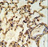 IMMP2L Antibody - IMP2L Antibody IHC of formalin-fixed and paraffin-embedded rat lung tissue followed by peroxidase-conjugated secondary antibody and DAB staining.