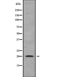 IMMP2L Antibody - Western blot analysis IMMP2L using HepG2 whole cells lysates