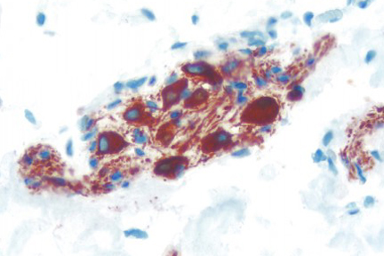 Product - Colon: Peripherin (m), ImmPRESS™ Anti-Mouse Ig Kit, ImmPACT™ AEC (red) substrate. Hematoxylin QS Counterstain (blue).