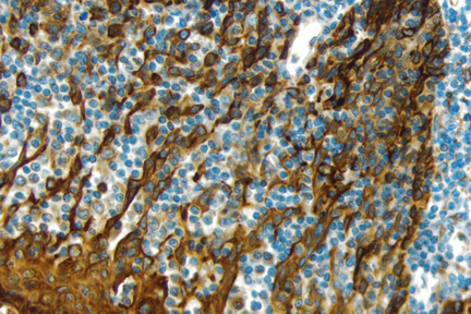 Product - Tonsil: Cytokeratin (m), ImmPRESS™ Anti-Mouse Ig Kit, ImmPACT™ DAB (brown) substrate. Hematoxylin (blue) counterstain.