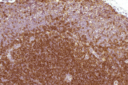Product - Rhesus macaque formalin/paraffin lymph node: CD4 (1F6), ImmPRESS™ Anti-Mouse Ig Kit, ImmPACT™ DAB substrate (brown). Hematoxylin counterstain (blue). Courtesy of Charles Brown, NIH, NIAID, Laboratory of Molecular Microbiology.