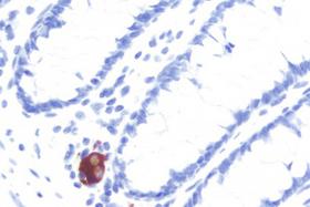 Product - Colon: Peripherin (m), ImmPRESS™ Anti-Mouse Ig Kit, ImmPACT™ NovaRED® (red) substrate. Hematoxylin QS (blue) counterstain.