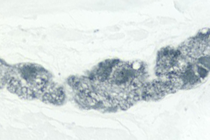 Product - Colon: PGP 9.5 (m), ImmPRESS™ Anti-Mouse Ig Kit, ImmPACT™ SG (blue-gray) substrate.