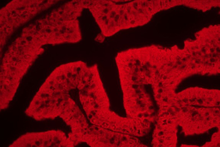 Product - Prostate: Anti-PSA (mouse monoclonal), ImmPRESS™ AP Anti-Mouse Ig Reagent (LS-J1054), ImmPACT™ Vector Red™ Alkaline Phosphatase Substrate (LS-J1087), viewed under fluorescence microscopy.