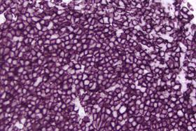Product - Tonsil: CD20 (m), ImmPRESS™ Anti-Mouse Ig Kit, ImmPACT™ VIP (purple) substrate.