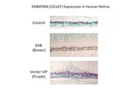 Product - EMMPRIN (CD147) Expression in human retina. Image kindly provided by Gail Seigel, University of Buffalo, Center for Hearing and Deafness.