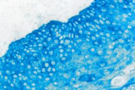 Product - Tonsil: Cytokeratin AE1/AE3 (m), ImmPRESS-AP anti-mouse Ig, Vector Blue™ (blue).
