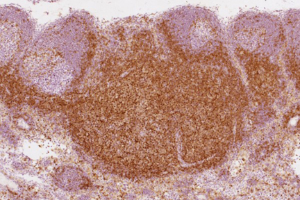 Product - Rhesus macaque formalin/paraffin lymph node: CD4 (1F6), ImmPRESS™ Anti-Mouse Ig Kit, ImmPACT™ DAB substrate (brown). Hematoxylin counterstain (blue). Courtesy of Charles Brown, NIH, NIAID, Laboratory of Molecular Microbiology.