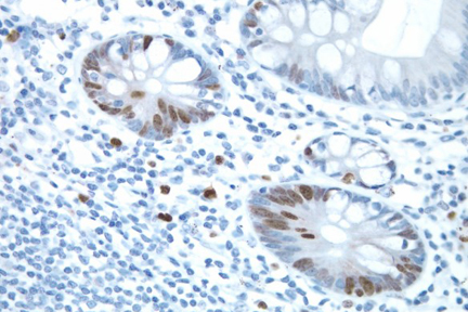 Product - Small bowel: ImmPRESS™ Anti-Rabbit Ig and DAB (brown) staining using Ki67 primary antibody. Hematoxylin counterstain (blue).