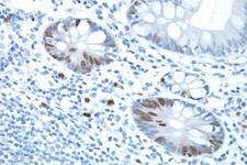 Small bowel: ImmPRESS™ Anti-Rabbit Ig and DAB (brown) staining using Ki67 primary antibody. Hematoxylin counterstain (blue).