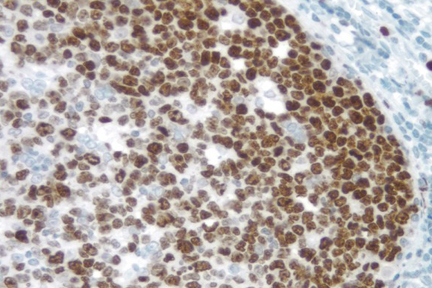 Product - Tonsil: Ki67 antigen detected using ImmPRESS™ Universal Reagent and Vector® DAB (brown) substrate. Hematoxylin QS (blue) counterstain.