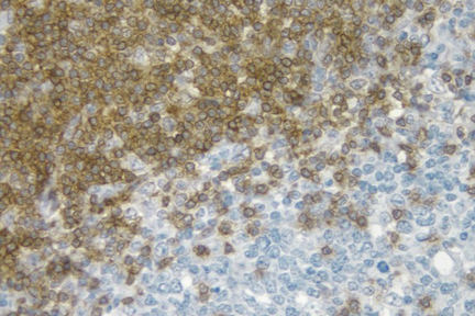 Product - Tonsil: CD3 antigen detected using ImmPRESS™ Universal Reagent and Vector® DAB (brown) substrate. Hematoxylin QS (blue) counterstain.