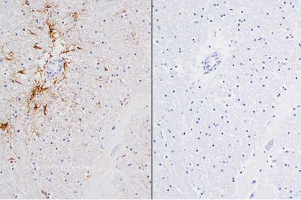 Product - Left: Cat brain stained with mouse antibody against GFAP and detected with ImmPRESS™ VR HRP Anti-Mosue IgG and ImmPACT™ DAB Substrate. Counterstainedwith Vector® Hematoxylin QS. Right: No mouse primary antibody negative control section displaying no background.