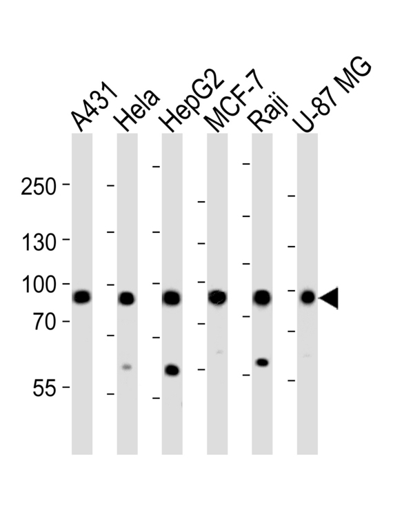IMMT / Mitofilin Antibody - Western blot of lysates from A431, HeLa, HepG2, MCF-7, Raji, U-87 MG cell line (from left to right) with IMMT Antibody. Antibody was diluted at 1:1000 at each lane. A goat anti-rabbit IgG H&L (HRP) at 1:5000 dilution was used as the secondary antibody. Lysates at 35 ug per lane.