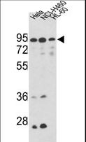 IMMT / Mitofilin Antibody - Western blot of IMMT Antibody in HeLa, NCI-H460, CEM cell line lysates (35 ug/lane). IMMT (arrow) was detected using the purified antibody.