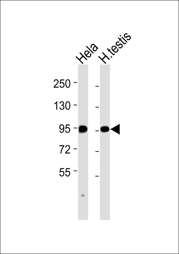 IMMT / Mitofilin Antibody - All lanes : Anti-Mitofilin Antibody at 1:1000 dilution Lane 1: HeLa whole cell lysates Lane 2: human testis lysates Lysates/proteins at 20 ug per lane. Secondary Goat Anti-Rabbit IgG, (H+L),Peroxidase conjugated at 1/10000 dilution Predicted band size : 84 kDa Blocking/Dilution buffer: 5% NFDM/TBST.