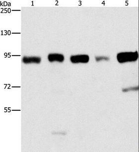 IMMT / Mitofilin Antibody - Western blot analysis of Raji and 231 cell, hepG2, HeLa, and 293T cell, using IMMT Polyclonal Antibody at dilution of 1:270.