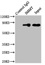 IMMT / Mitofilin Antibody - Immunoprecipitating IMMT in HepG2 whole cell lysate Lane 1: Rabbit monoclonal IgG (1µg) instead of product in HepG2 whole cell lysate.For western blotting,a HRP-conjugated Protein G antibody was used as the Secondary antibody (1/2000) Lane 2: product (8µg) + HepG2 whole cell lysate (500µg) Lane 3: HepG2 whole cell lysate (10µg)