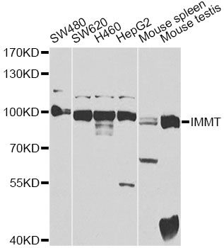 IMMT / Mitofilin Antibody - Western blot analysis of extracts of various cell lines, using IMMT antibody at 1:400 dilution. The secondary antibody used was an HRP Goat Anti-Rabbit IgG (H+L) at 1:10000 dilution. Lysates were loaded 25ug per lane and 3% nonfat dry milk in TBST was used for blocking. An ECL Kit was used for detection and the exposure time was 10s.