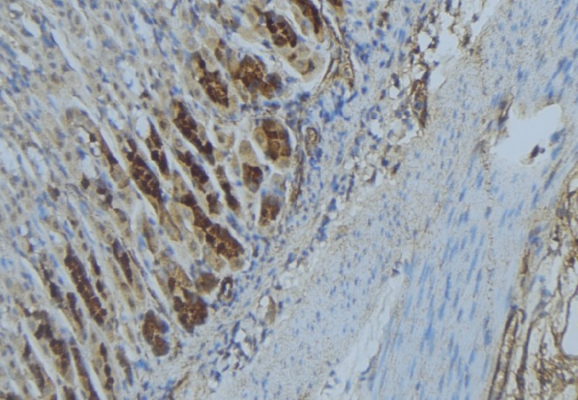 IMMT / Mitofilin Antibody - 1:100 staining human gastric tissue by IHC-P. The sample was formaldehyde fixed and a heat mediated antigen retrieval step in citrate buffer was performed. The sample was then blocked and incubated with the antibody for 1.5 hours at 22°C. An HRP conjugated goat anti-rabbit antibody was used as the secondary.