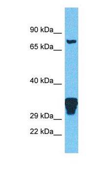 IMMT / Mitofilin Antibody - Western blot of IMMT Antibody with human 293T Whole Cell lysate.  This image was taken for the unconjugated form of this product. Other forms have not been tested.