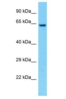 IMP-3 / IGF2BP3 Antibody - IMP-3 / IGF2BP3 antibody Western Blot of 721_B. Antibody dilution: 1 ug/ml.  This image was taken for the unconjugated form of this product. Other forms have not been tested.