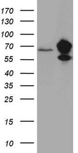 IMP-3 / IGF2BP3 Antibody - HEK293T cells were transfected with the pCMV6-ENTRY control. (Left lane) or pCMV6-ENTRY IGF2BP3. (Right lane) cDNA for 48 hrs and lysed. Equivalent amounts of cell lysates. (5 ug per lane) were separated by SDS-PAGE and immunoblotted with anti-IGF2BP3. (1:2000)