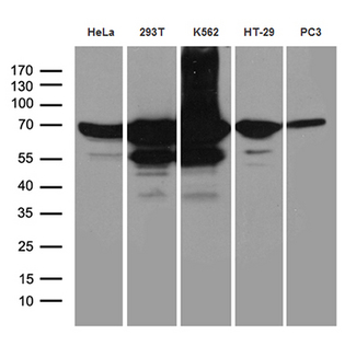 IMP-3 / IGF2BP3 Antibody - Western blot analysis of extracts. (35ug) from 5 different cell lines by using anti-IGF2BP3 monoclonal antibody. (1:500)