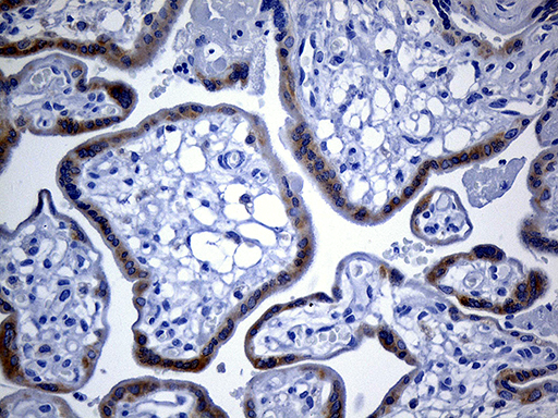 IMP-3 / IGF2BP3 Antibody - Immunohistochemical staining of paraffin-embedded Human placenta tissue within the normal limits using anti-IGF2BP3 mouse monoclonal antibody. (Heat-induced epitope retrieval by 1mM EDTA in 10mM Tris buffer. (pH8.5) at 120 oC for 3 min. (1:250)
