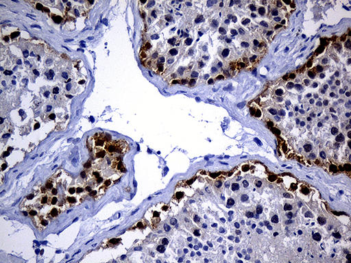 IMP-3 / IGF2BP3 Antibody - Immunohistochemical staining of paraffin-embedded Human testicle tissue within the normal limits using anti-IGF2BP3 mouse monoclonal antibody. (Heat-induced epitope retrieval by 1mM EDTA in 10mM Tris buffer. (pH8.5) at 120°C for 3 min. (1:250)