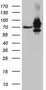 IMP-3 / IGF2BP3 Antibody - HEK293T cells were transfected with the pCMV6-ENTRY control. (Left lane) or pCMV6-ENTRY IGF2BP3. (Right lane) cDNA for 48 hrs and lysed. Equivalent amounts of cell lysates. (5 ug per lane) were separated by SDS-PAGE and immunoblotted with anti-IGF2BP3. (1:2000)