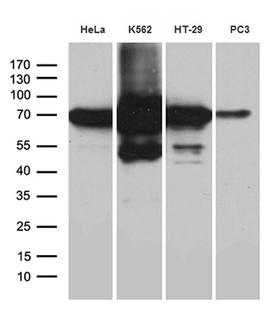 IMP-3 / IGF2BP3 Antibody - Western blot analysis of extracts. (35ug) from 4 different cell lines by using anti-IGF2BP3 monoclonal antibody. (1:500)