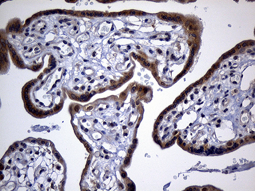 IMP-3 / IGF2BP3 Antibody - Immunohistochemical staining of paraffin-embedded Human placenta tissue within the normal limits using anti-IGF2BP3 mouse monoclonal antibody. (Heat-induced epitope retrieval by 1mM EDTA in 10mM Tris buffer. (pH8.5) at 120 oC for 3 min. (1:500)