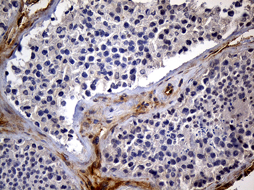 IMP-3 / IGF2BP3 Antibody - Immunohistochemical staining of paraffin-embedded Human testicle tissue within the normal limits using anti-IGF2BP3 mouse monoclonal antibody. (Heat-induced epitope retrieval by 1mM EDTA in 10mM Tris buffer. (pH8.5) at 120°C for 3 min. (1:500)