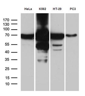 IMP-3 / IGF2BP3 Antibody - Western blot analysis of extracts. (35ug) from 4 different cell lines by using anti-IGF2BP3 monoclonal antibody. (1:500)