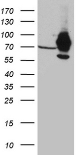 IMP-3 / IGF2BP3 Antibody - HEK293T cells were transfected with the pCMV6-ENTRY control. (Left lane) or pCMV6-ENTRY IGF2BP3. (Right lane) cDNA for 48 hrs and lysed