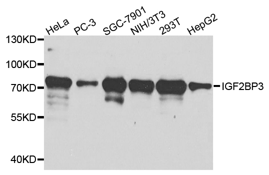 IMP-3 / IGF2BP3 Antibody - Western blot analysis of extract of various cells.