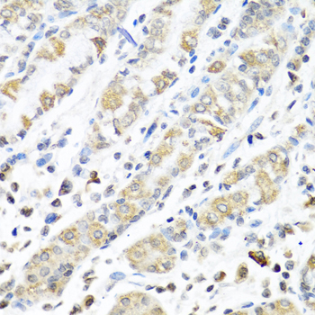 IMP-3 / IGF2BP3 Antibody - Immunohistochemistry of paraffin-embedded human stomach tissue.