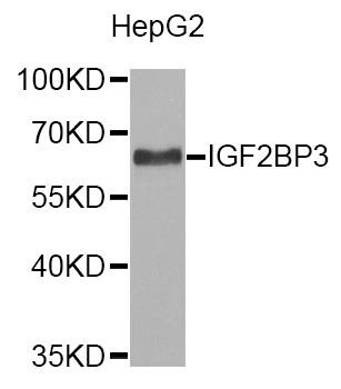 IMP-3 / IGF2BP3 Antibody - Western blot analysis of extracts of HepG2 cells.