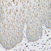 IMP-3 / IGF2BP3 Antibody - Immunohistochemistry of paraffin-embedded human esophagus.